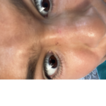 tbozzOP3