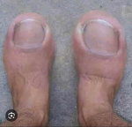 Toes.