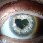 iris7