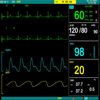Heart moniter screen Roblox decal