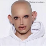 kaki james charles berdarah