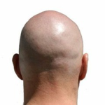 Devyon