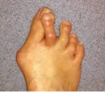 Peanut Butter Feet