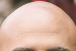 BALDIES!!!