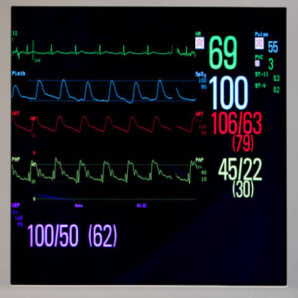 Heart Monitor  Roblox decal