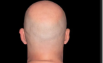 BALD MEN KINGDOM