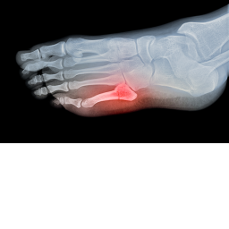 C/K Runway Corporation