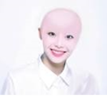 Bald Chuu is the best