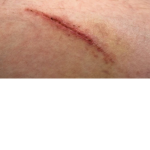 Battle scar studios