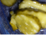 urgentas