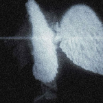 -xxs