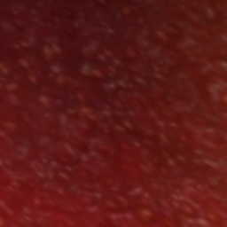 Trypophobia