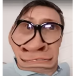 bignose