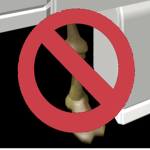 Stop Skeleton Leg