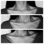 scars like reminders