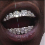 Repno™