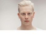 Albino Men