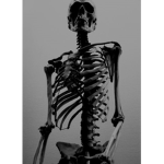 Septicemia OS