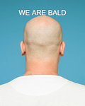 Balds Matter