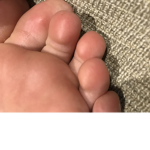 Extremely_Cheesy_Toes