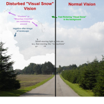 Visual Snow