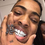 $
