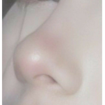 KYMISS