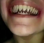 sharp fangs