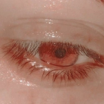 blood_Eyes Group Thumbnail