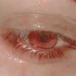 blood_Eyes Group Thumbnail