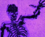 [ Content Deleted 33182262 ]