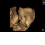 join if my baby brothers cute!
