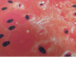 Watermelons club