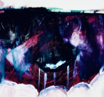 Neuropraxia