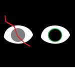 A Blind Eye