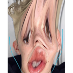 Mika Tinline Yt (Adde)