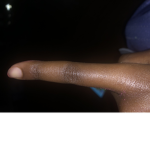 Fingers:)