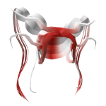 Hydra