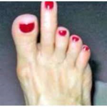 big stanky toe