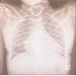 Toxic cuties