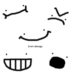 Brain Damage Development