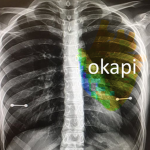 Okapi