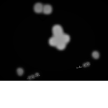 原因。近くです。