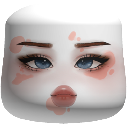 Cold Blushy Cute Girl [Vitiligo]