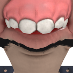 @DernipoG