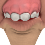 @YTforticd