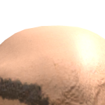 @at1044