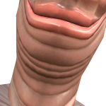 @NoComplements