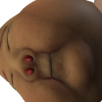 @FW_BP