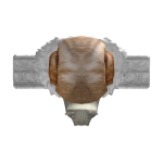 @shallow_slicer